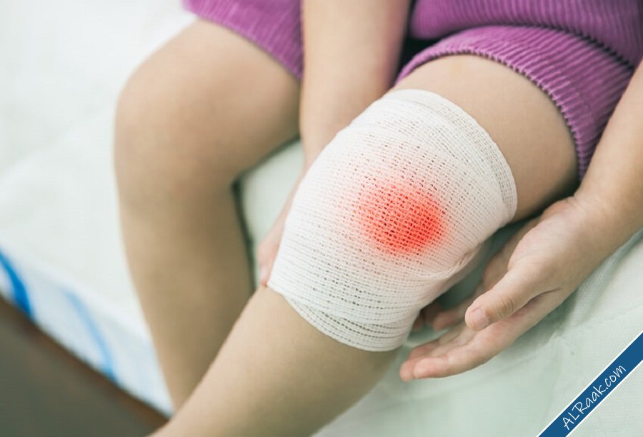 10 أخطاء شائعة في الإسعافات الأولية يرتكبها الجميع دون قصد-9.jpg